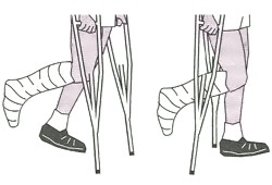 Beneficios de usar muletas