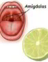 ¿Cómo utilizar el limón para curar las anginas?