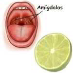 ¿Cómo utilizar el limón para curar las anginas?