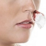 ¿Cómo evitar y parar la salida de sangre por la nariz?