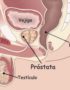 ¿Cómo cuidar la próstata desde joven?
