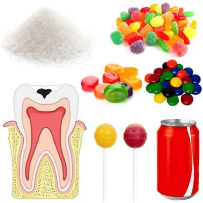  De Qu Forma Influye La Ingesta De Az car En La Formaci n De Caries 